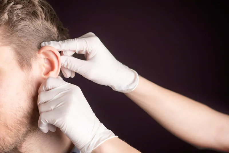 Kepçe kulak estetiği otoplasti — Prof. Dr. Esin Yalçınkaya
